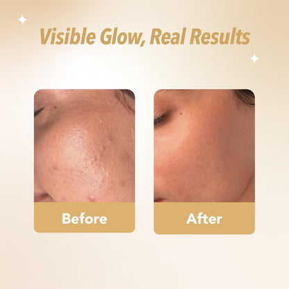 Before and after skin glow transformation showing smoother, radiant complexion with visible results